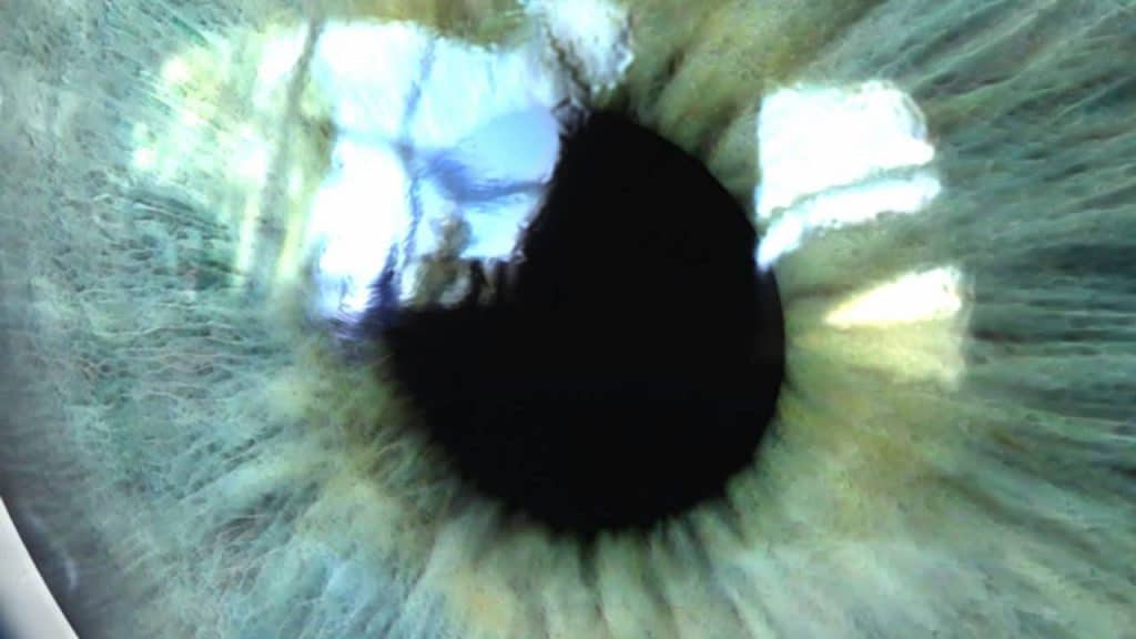 pupillary distance regional eye center